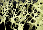 osteo_nsxs.png