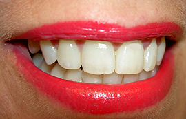 Gesunde Mundflora schützt Zähne und Zahnfleisch