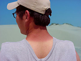 Schutz und Stärkung der Haut besonders im Sommer gefragt